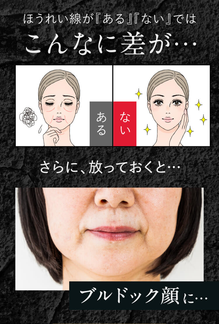 ほうれい線が『ある』『ない』ではこんなに差が…